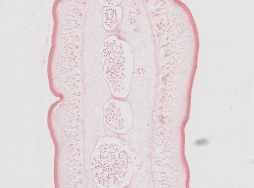 Taenia saginata