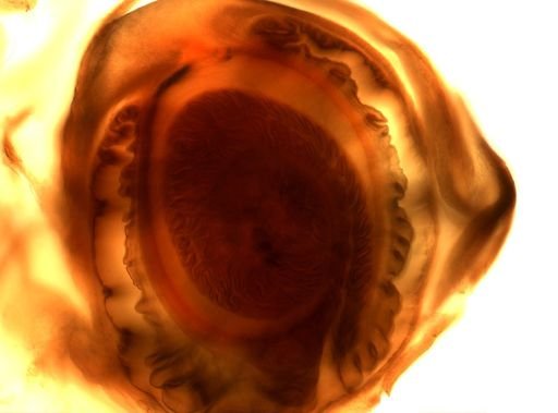 Taenia solium