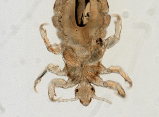 Pediculus humanus