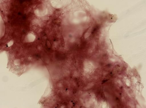 Dysidea fragilis