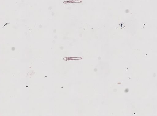 Protohydra leuckarti