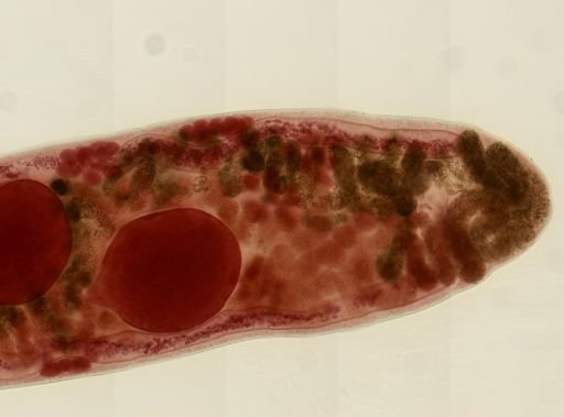 Haematoloechus medioplexus