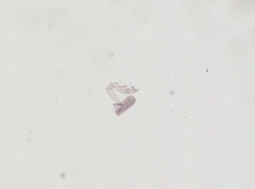 Hyalella cf. azteca