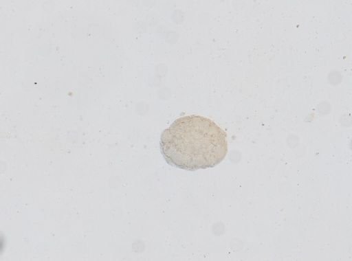 Dipylidium caninum