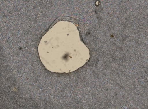Lepadella patella