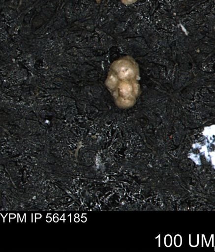 Verneuilina canadensis