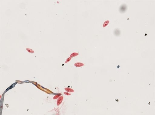 Paramecium calkinsi