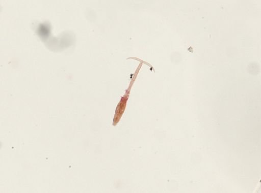 Schistosoma mansoni
