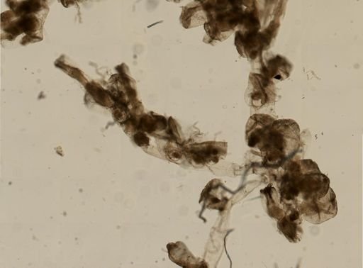 Bryozoa