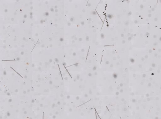 Cliona sp.