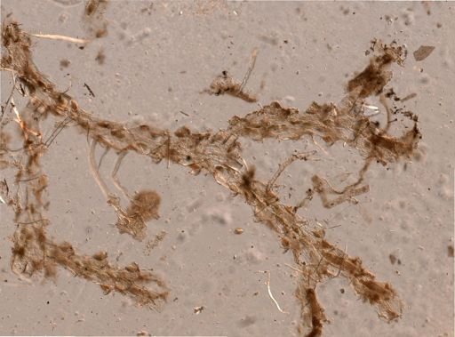 Bryozoa