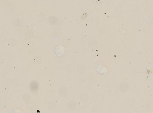 Hymenolepis diminuta