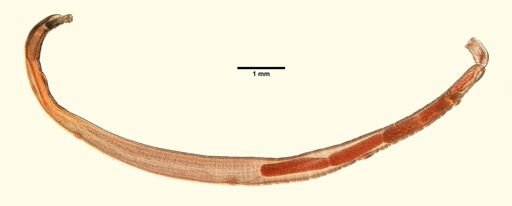 Acanthocephala