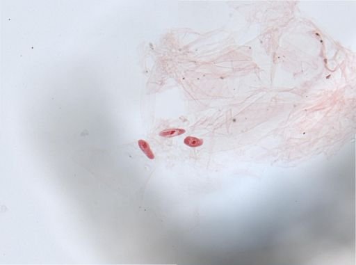 Paramecium