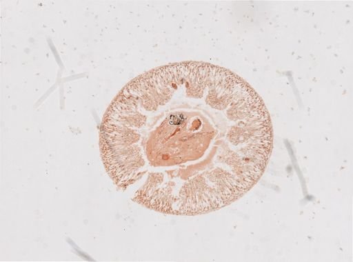 Lithobius forficatus