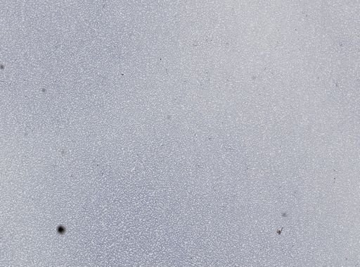 Plasmodium vivax