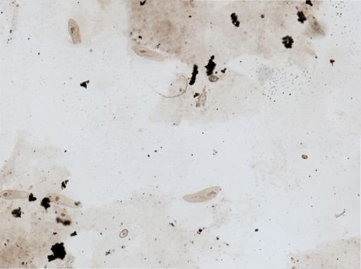 Paramecium aurelia
