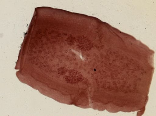 Dipylidium caninum