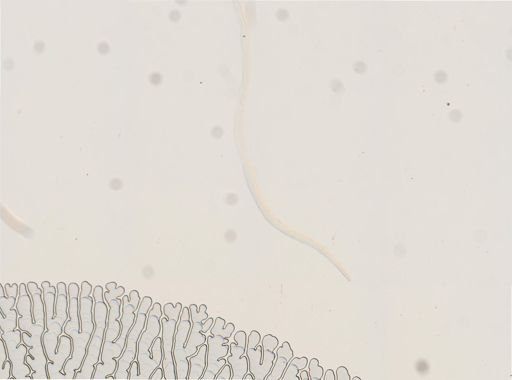 Strongyloides