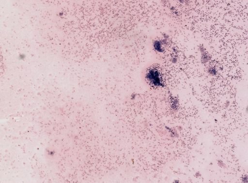 Trypanosoma