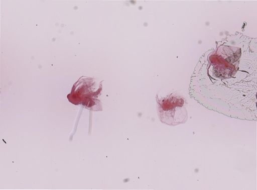 Ceriodaphnia