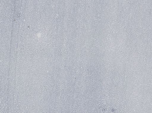 Plasmodium vivax
