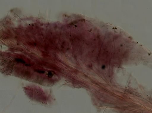 Axinella