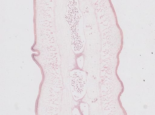 Taenia saginata