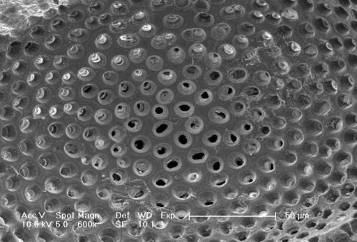 Neogloboquadrina dutertrei