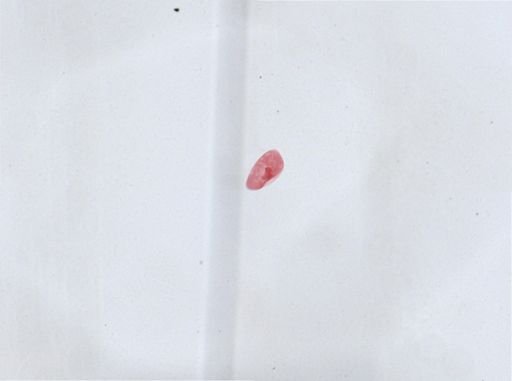 Paramecium aurelia