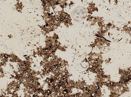 Aulacoseira italica