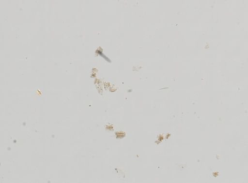 Hydrobiidae