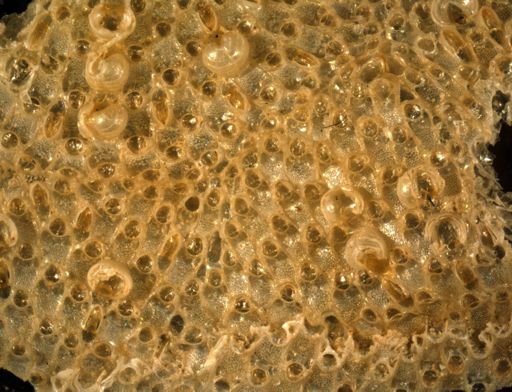 Thalamoporella gothica