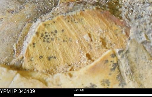 Protocardia?