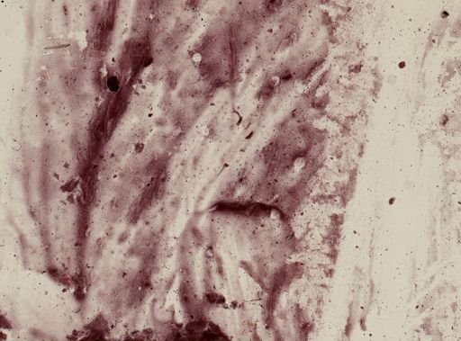 Giardia lamblia