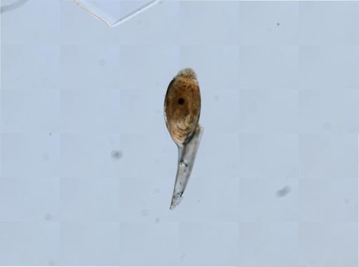 Pthirus pubis