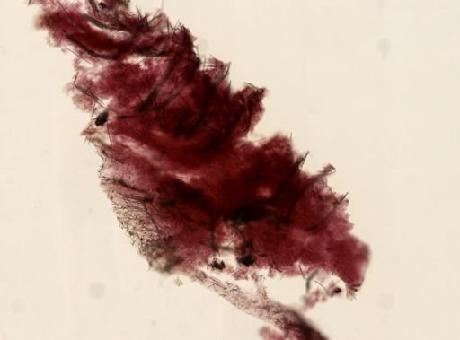 Kirkpatrickia