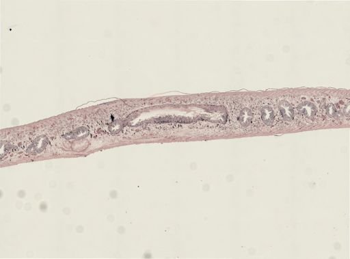 Turbellaria