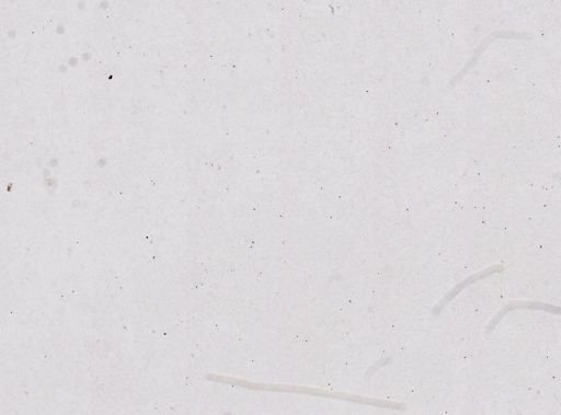 Trypanosoma brucei