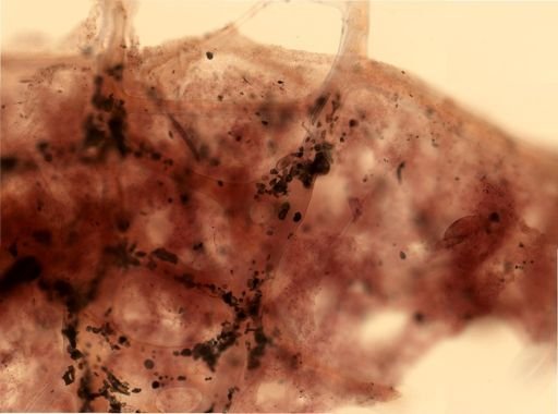 Keratosa