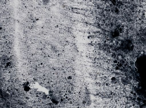 Entamoeba histolytica