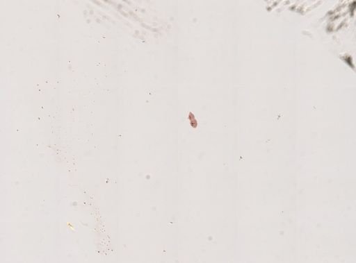 Paramecium caudatum