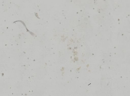 Bythinella viridis