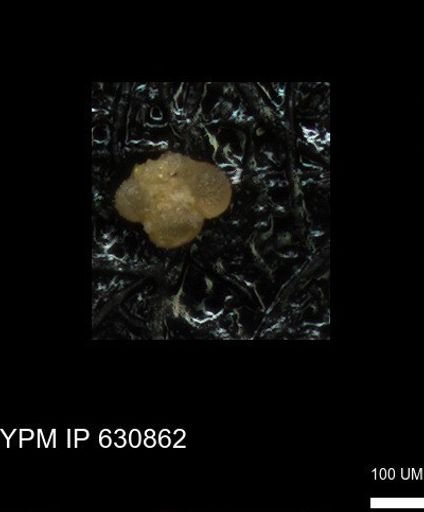 undet. Rugoglobigerinidae