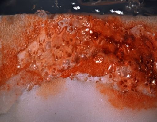 Thalamoporella nr. stapifera