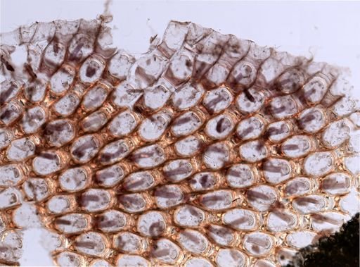 Bryozoa