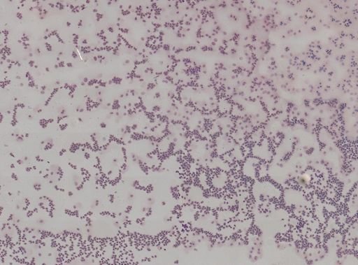 Trypanosoma