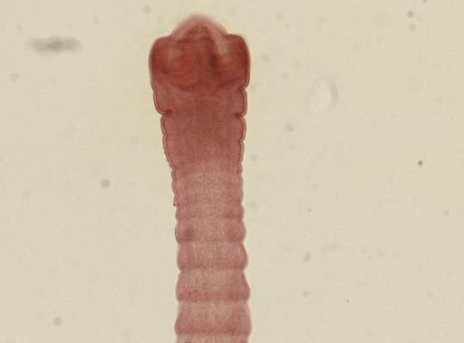 Dipylidium caninum