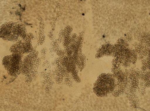 Diphyllobothrium latum