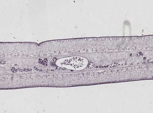 Taenia saginata
